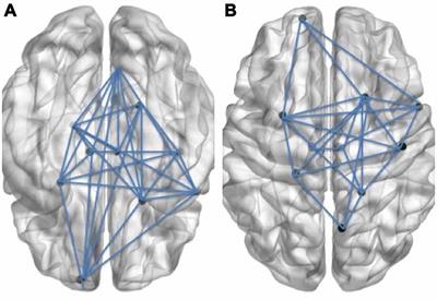 Second Language Word Learning through Repetition and Imitation: Functional Networks as a Function of Learning Phase and Language Distance